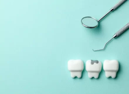 虫歯は放置するとどうなる？今すぐ歯医者に行った方がいい理由